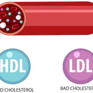 Cholesterol: Debunking the Good vs. Bad Myth