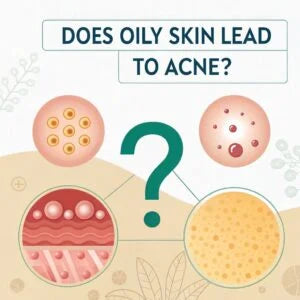 Does Oily Skin Lead to Acne?