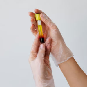 What Is Plasma and Why Is It So Valuable?