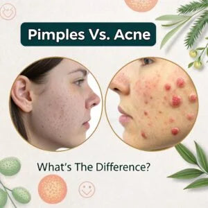 Pimples vs. Acne: What’s the Difference?